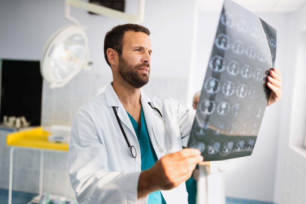 Doctor examining brain MRI film